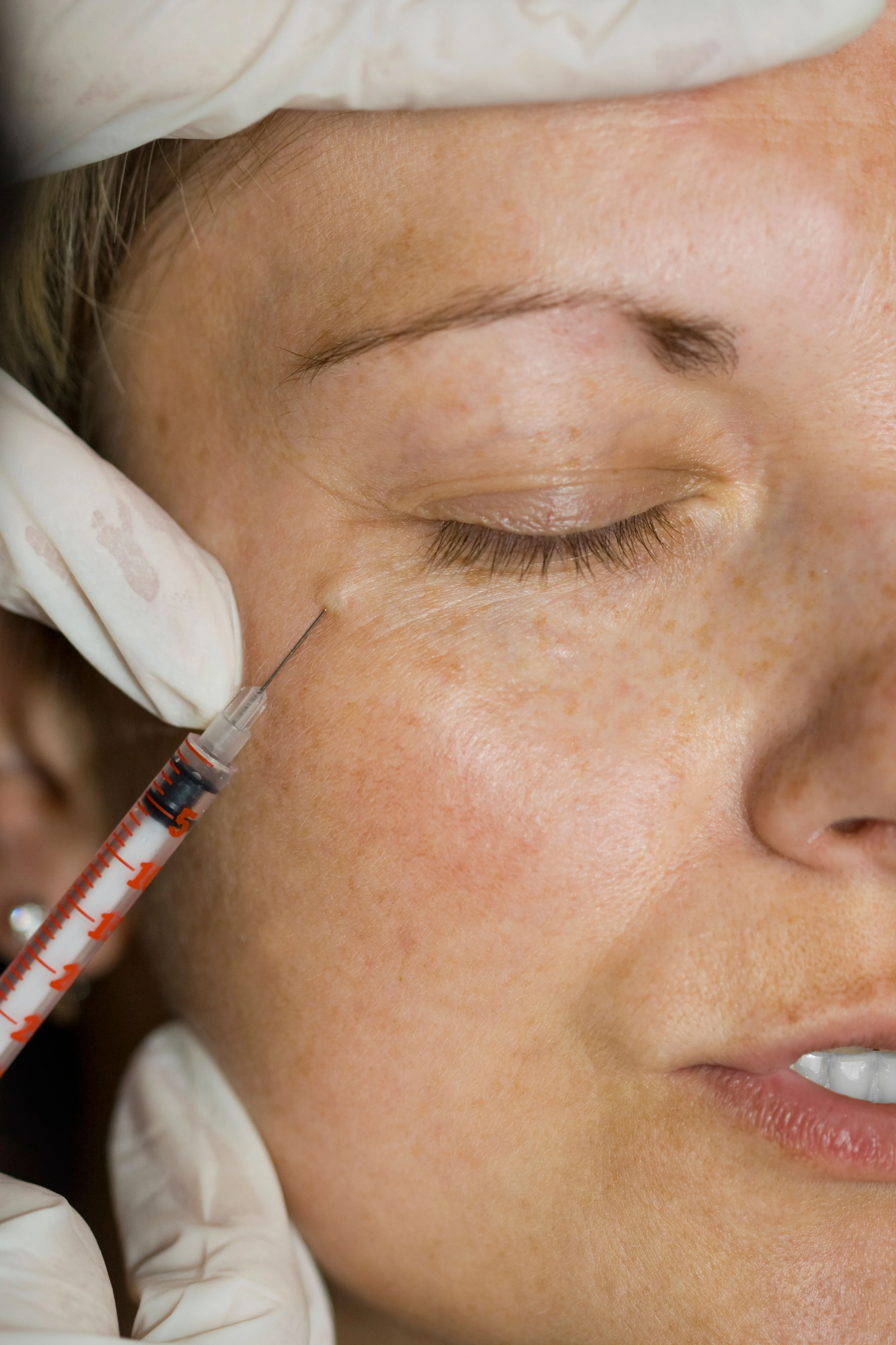 The Best Of Aesthetic Procedures At HSJ Clinic, Mallorca 8.jpg