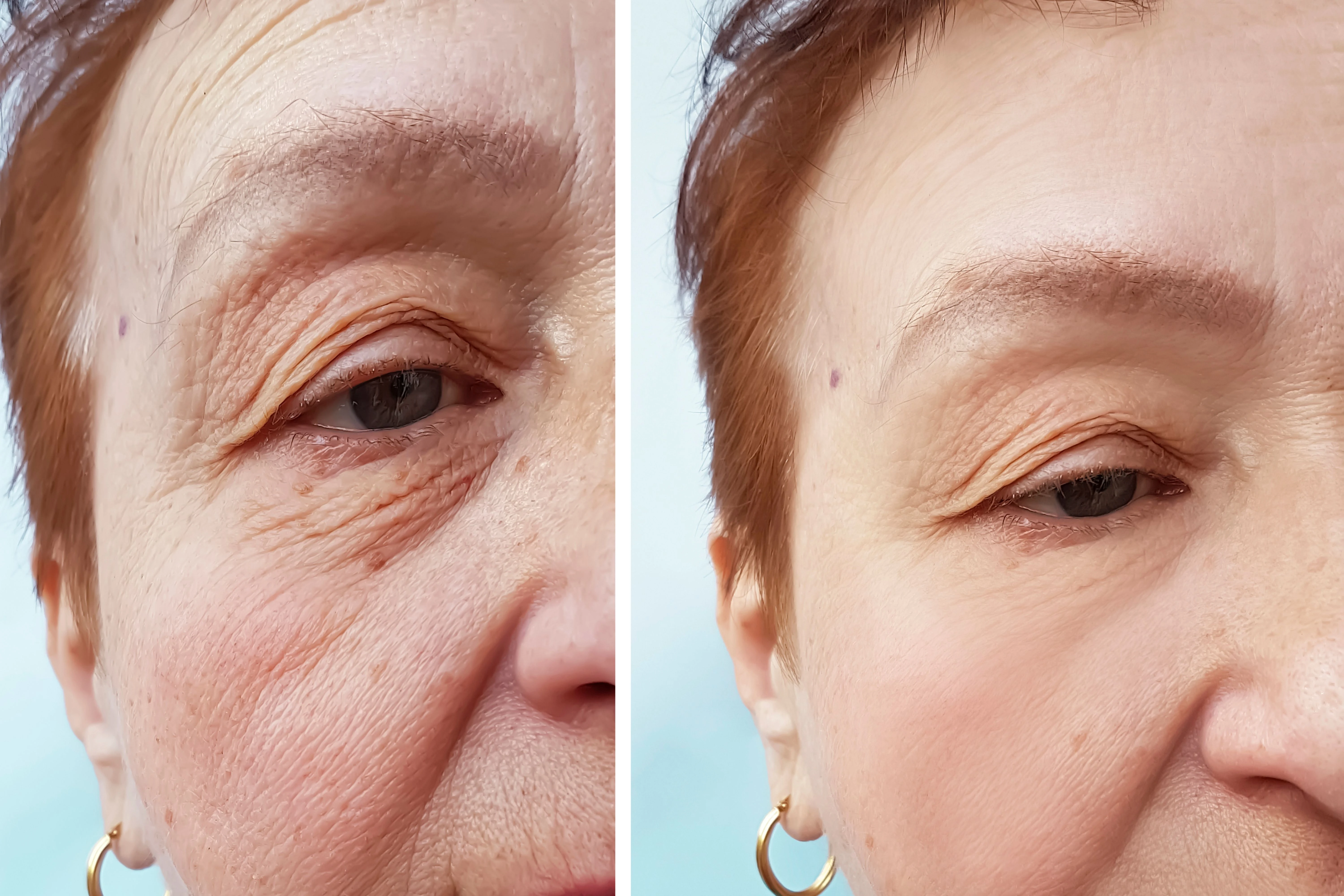 Experience The Best Of Aesthetic Procedures At HSJ Clinic, Mallorca
