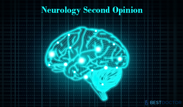 Neurology-Second-Opinion.jpg
